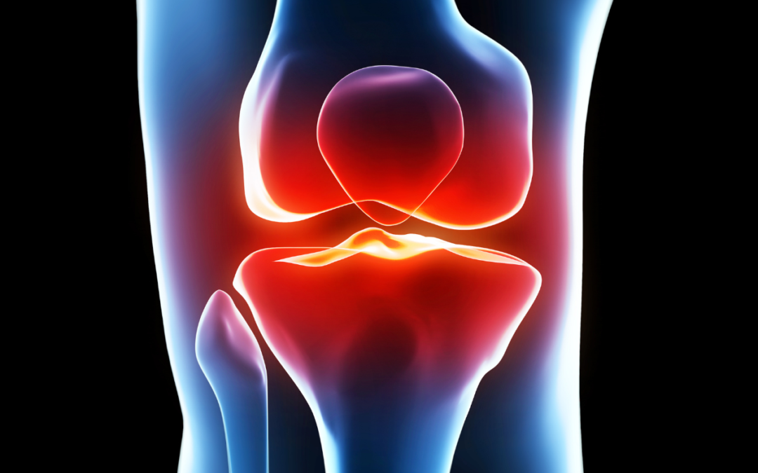 Private Knee MRI