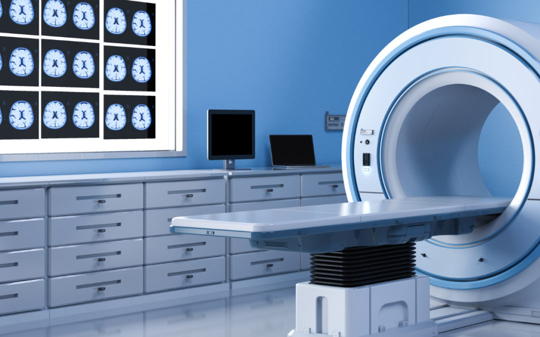Head and Neurological MRI Scans in Leeds: When Might You Need One?