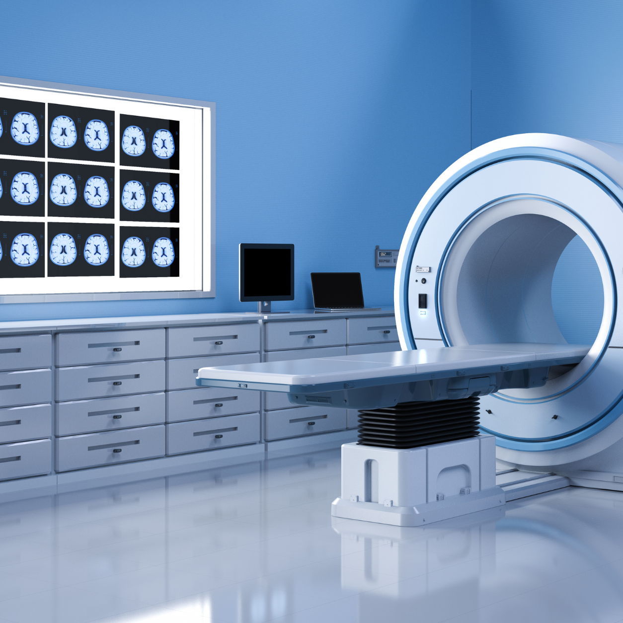 MRI scanner room used for private head and neurological MRI scans in Leeds