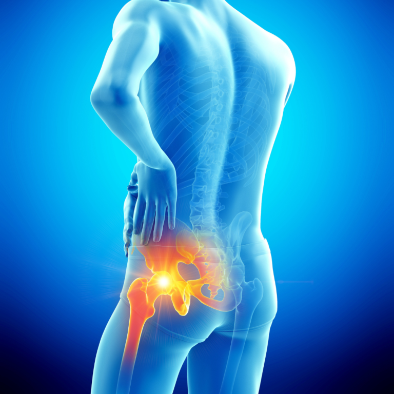 Private Hip & Pelvis MRI in Leeds